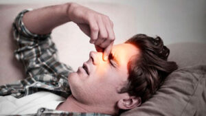 Images sinusitis
